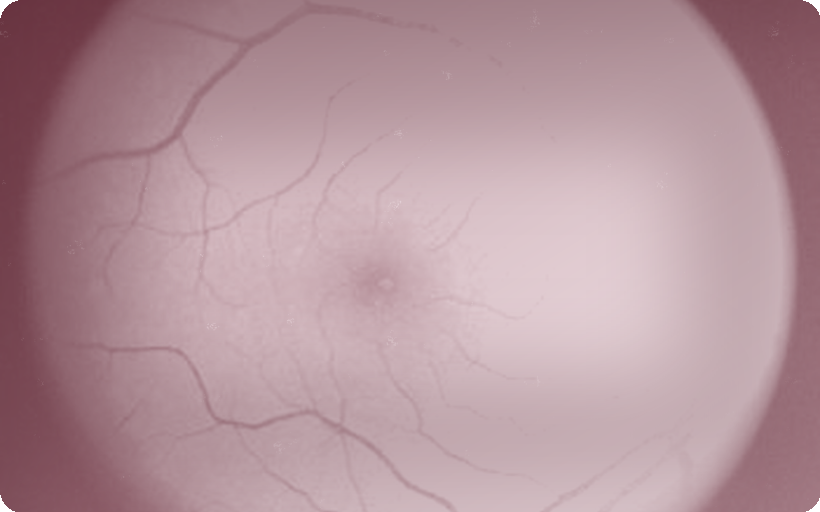 Fovea, our drafter, named for the fovea, the pit in the retina where vision is sharpest
